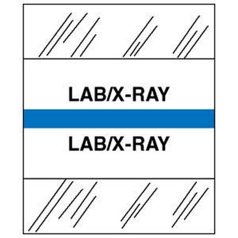 Lab/X-Ray Chart Divider Tabs, 1-1/4" x 1/2", Light Blue (Pack of 100)