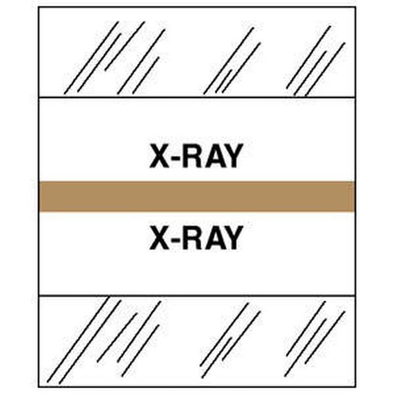 X-Ray Chart Divider Tabs, 1-1/4" x 1/2", Tan (Pack of 100)