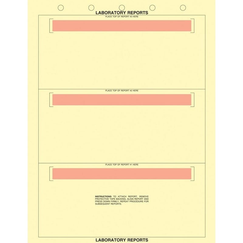 8-1/2" x 11" Canary Laboratory Report Sheets, 5 Hole Punch, Horizontal Adhesive Strips, Fits 3 Reports (500 per Box)